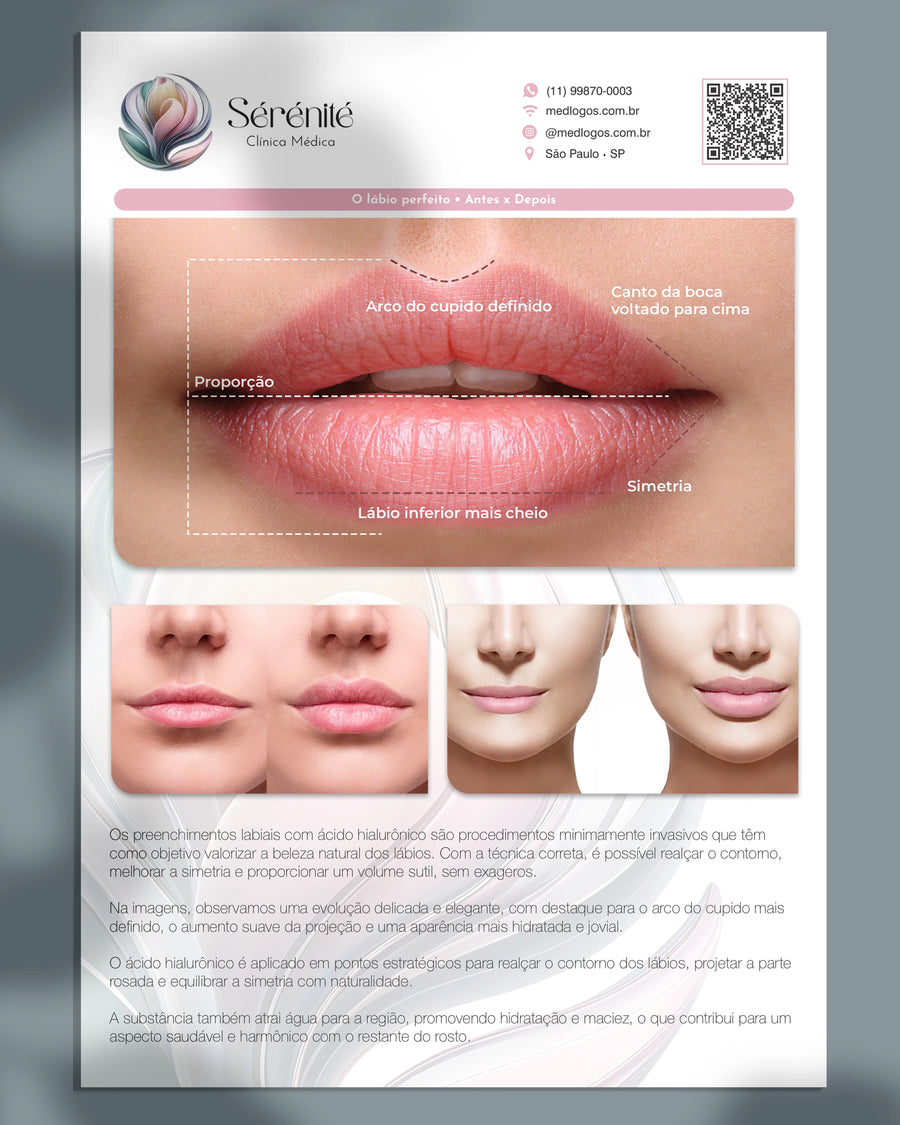 Lâmina explicativa sobre preenchimento labial