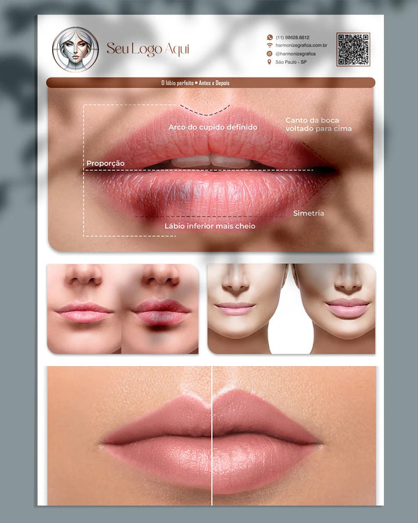 Lâmina explicativa sobre preenchimento labial
