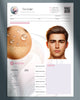 Ficha para registro técnico de preenchimento facial com ácido hialurônico em homens. Impressão premium.